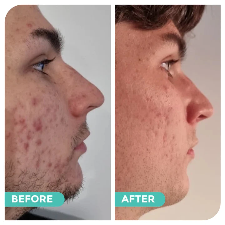 Avocado & Hemp Green Clay Mask By Hemp Co Australia 5 Avocado & Hemp Green Clay Mask By Hemp Co Australia - Image 5