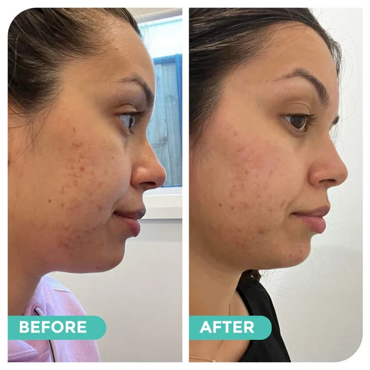 Avocado & Hemp Green Clay Mask By Hemp Co Australia 8 Avocado & Hemp Green Clay Mask By Hemp Co Australia - Image 8